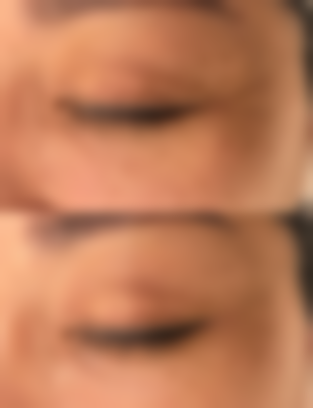 长春枫芸恩喜整形医院项目特色