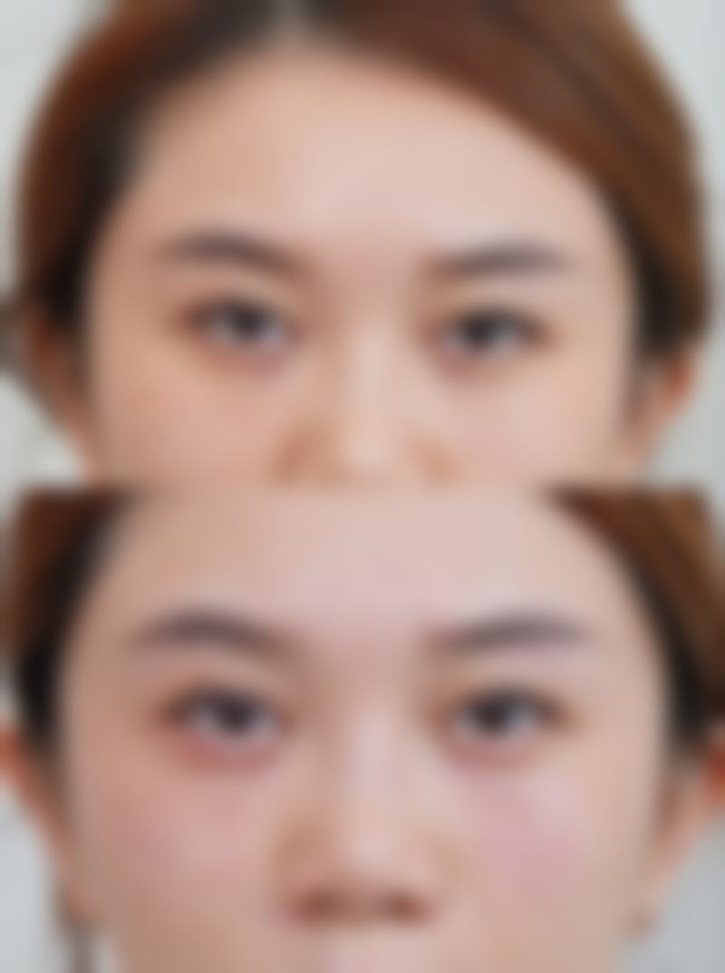 如果女人因睡眠不足有眼袋怎样祛除:熬夜党的救赎
