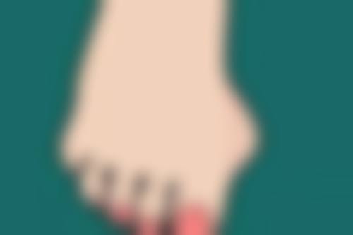 全切双眼皮多久红色线能消失之三等甲医院与私立医院大比拼