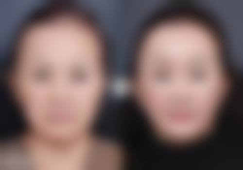 去眼袋什么更好更有效之护肤品甄选指南