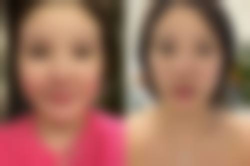 日常护理:预防胜于治疗,小习惯带来大改变