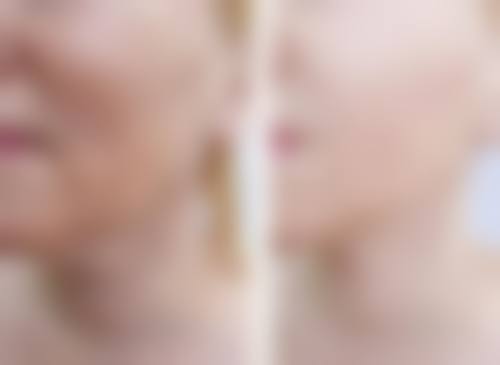 隆胸一般隆多大合适之不同身材的专属选杯指南