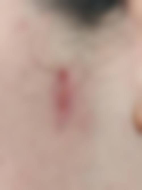 宜宾悦莱整形医院口碑评价如何