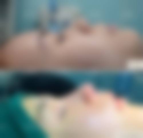 西安美人鱼医疗美容门诊部怎么样，价格表情况