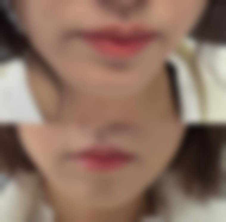 自然抗皱替代方案