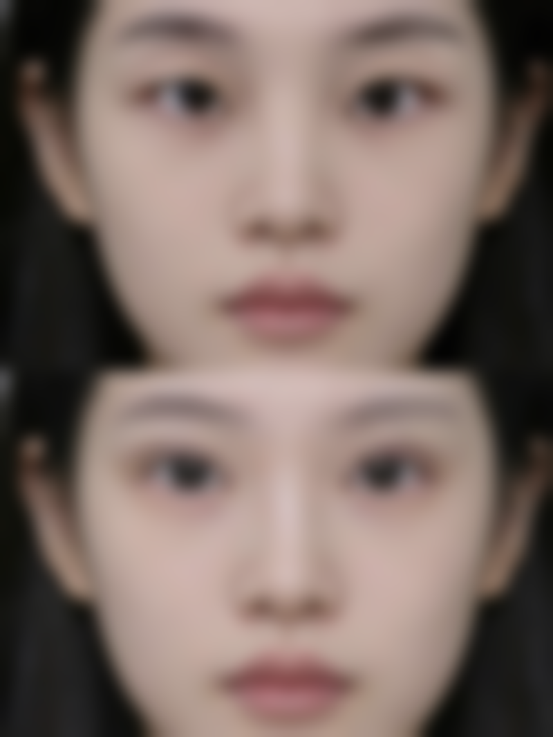 抽脂瘦大腿安心吗——医生技术与安心的紧密关系