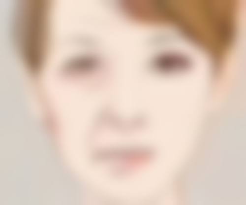 双眼皮埋线危险吗？感染肿胀风险大揭秘，年轻人老年人必看避坑指南