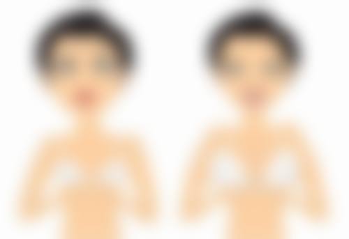 割双眼皮要肿多久之警惕异常情况:及时就医疗保险健康