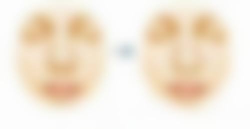 割双眼皮要肿多久之医院类型抉择:哪家医院助你快速消肿