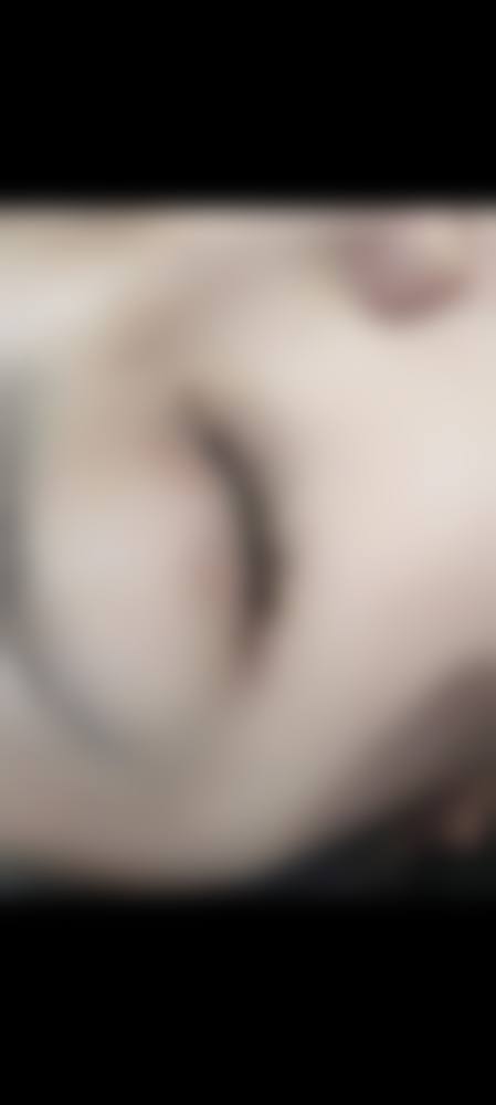 刘煜阳医生项目优势