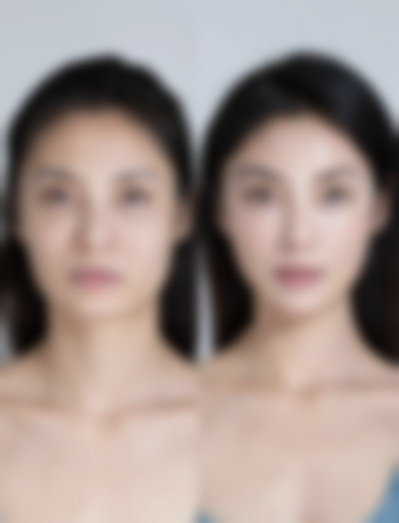 祛痣疤痕多久可以恢复？激光/手术祛疤恢复时间大揭秘