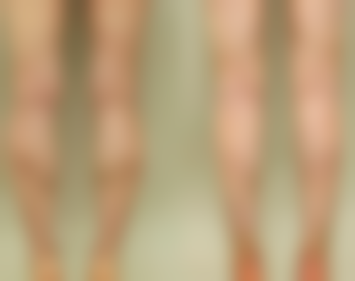 如何平衡减肥与双眼皮手术:速度控制是关键