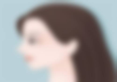 全切/埋线双眼皮喝豆浆有区别吗？骨干医生深度解析