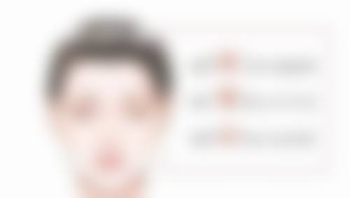 割双眼皮分阶段修复多久可以翻白眼