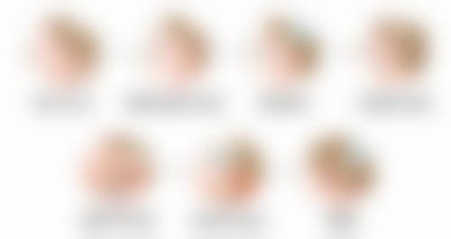 割双眼皮一个月后多久可以翻白眼：修复不错但仍需谨慎