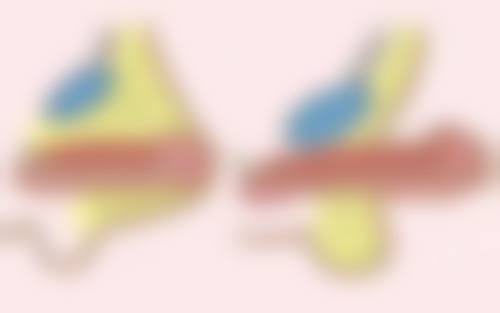 如何平衡减肥与双眼皮手术:专精询问特别必要