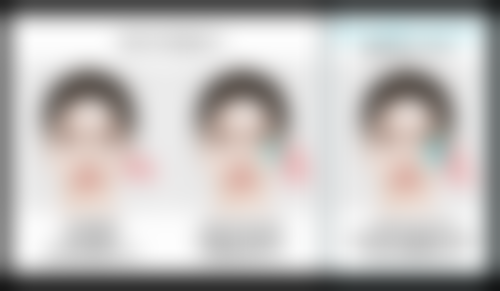 本地医院 vs 外地医院——距离与肚子吸脂安心的权衡