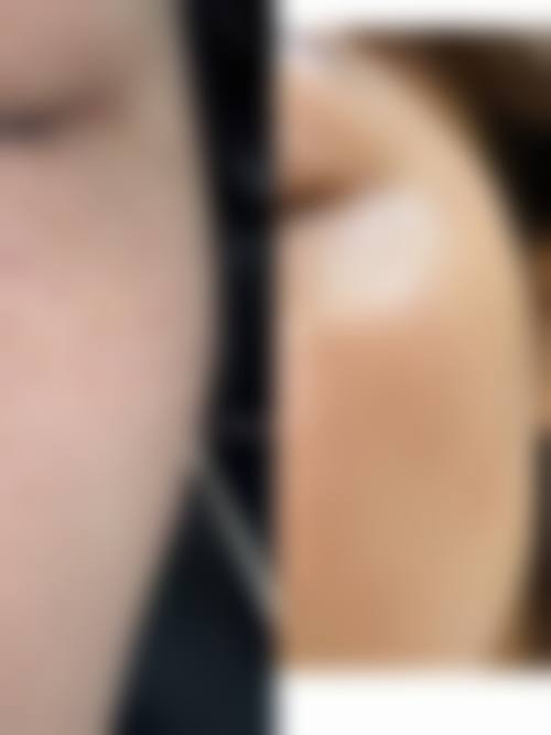 深圳缦缦医疗美容诊所怎么样，更擅长什么手术