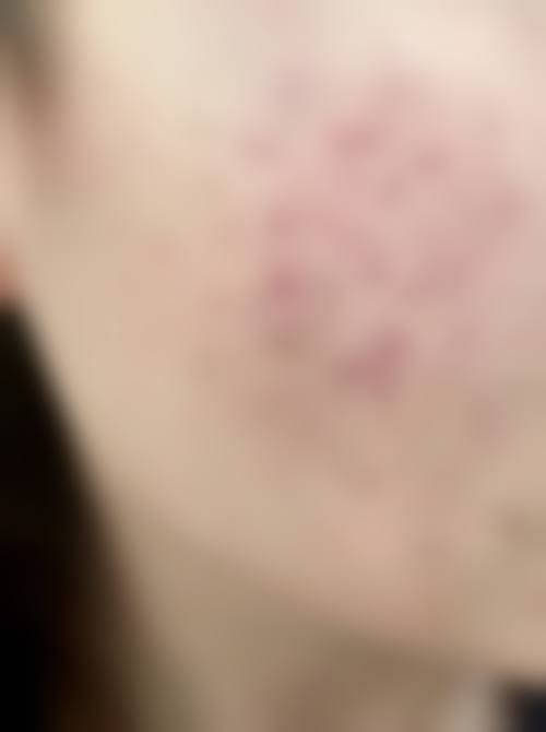 漳州碧湖星博仕整形医院价格表