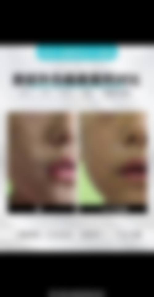 九江开发区瑞丽医疗美容门诊部顾客实例