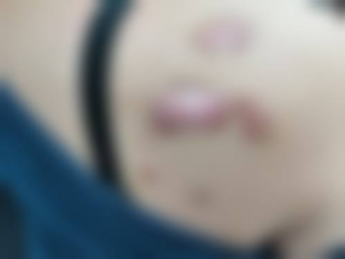 大连新日里英皓医疗美容诊所更擅长什么手术