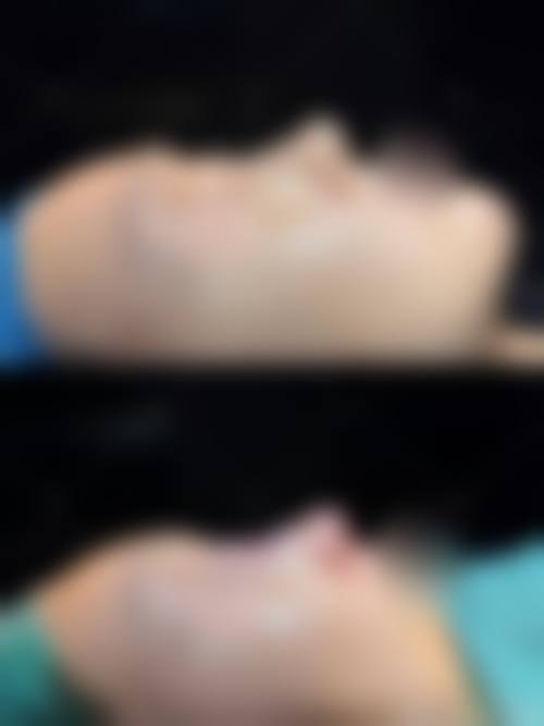 成都李修肤华塑整形李则冈2026全新价目表——颜所FILL×SKIN美肤诊所