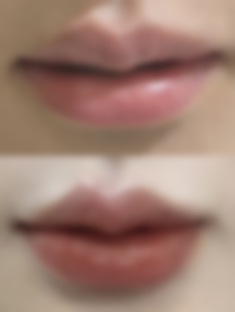 割双眼皮后喝豆浆会发炎吗？具有影响力破除常见误区