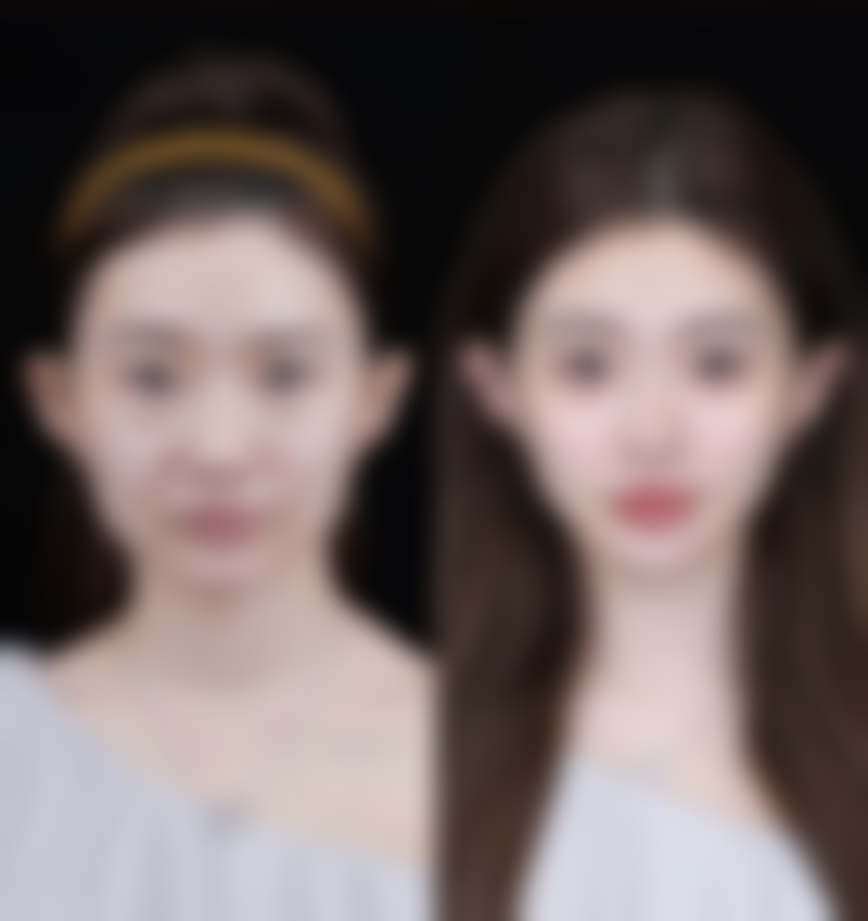 薛凯医生做手术价格