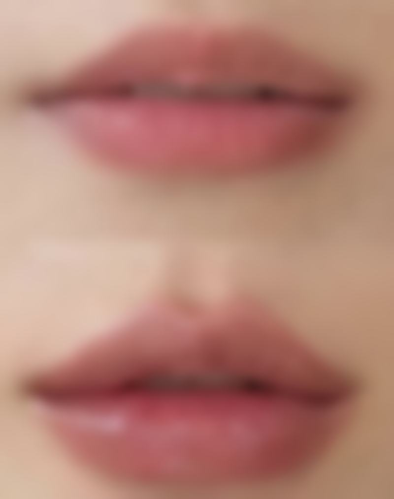 韩国KIWI整形外科口碑好不好