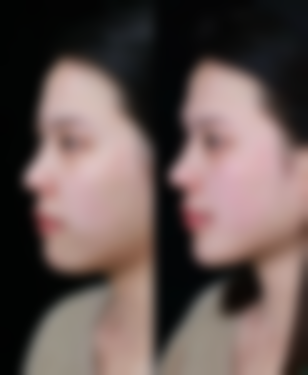 尾段:理性看待抽脂,健康美才是真美