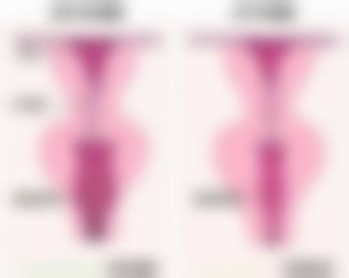 三等甲医院药物注射治疗胸前痘痘疤痕疙瘩:内部瓦解,消除隐患