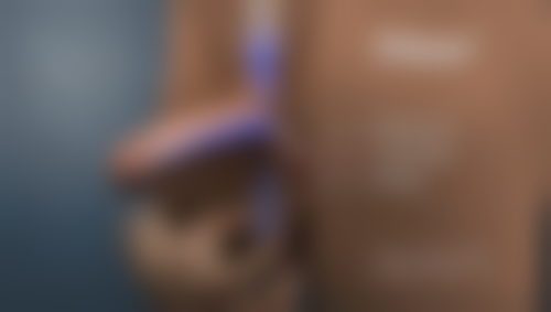 Park双眼皮的特点是什么