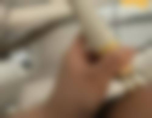 三等甲医院光电治疗疤痕修复设备与团队优势怎么样