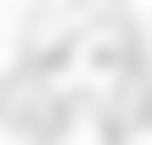 双眼皮割了有后遗症吗——视力下降：更可怕的潜在风险