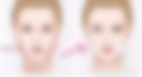 感染移位风险下隆鼻假体对人体有害吗——如何让假体乖乖听话攻略