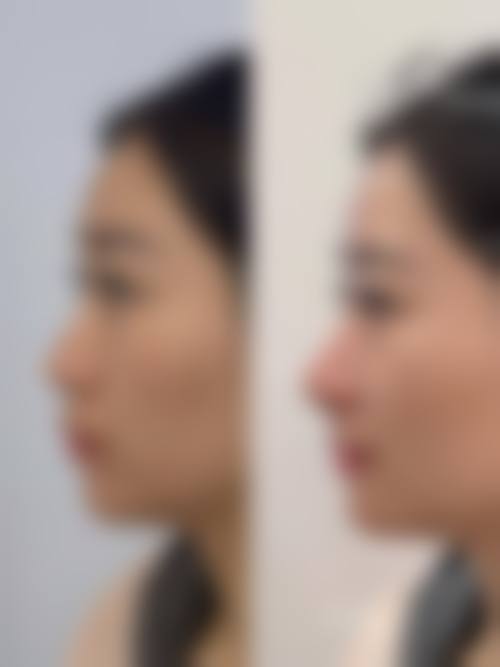 韩国merry整形外科正规吗