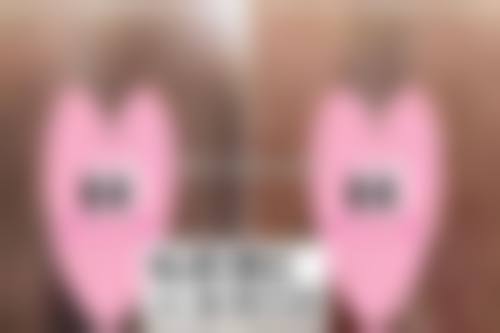 上海德琳医疗美容医院（男性私密中 心）乐威手术成效展示