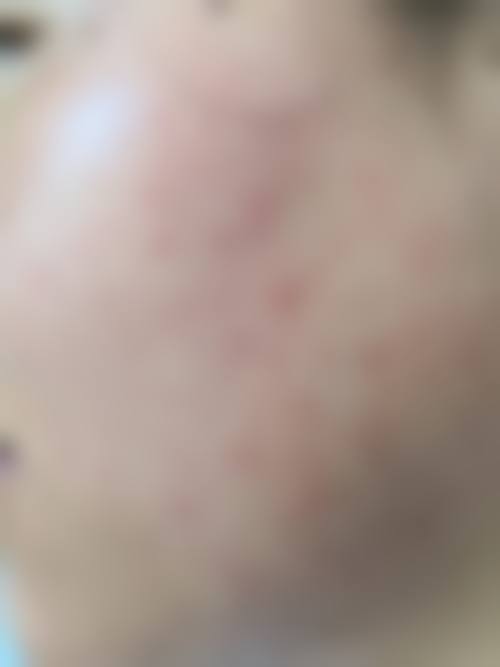 广州心安医疗美容门诊部怎么样