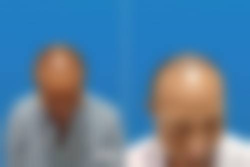 大连达美元辰植发怎么样，其资质如何？