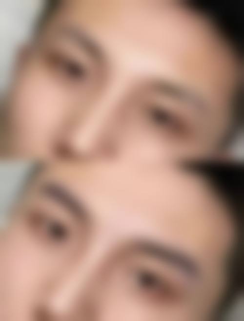 大连达美元辰植发怎么样，抖音团购活动和价格表情况？