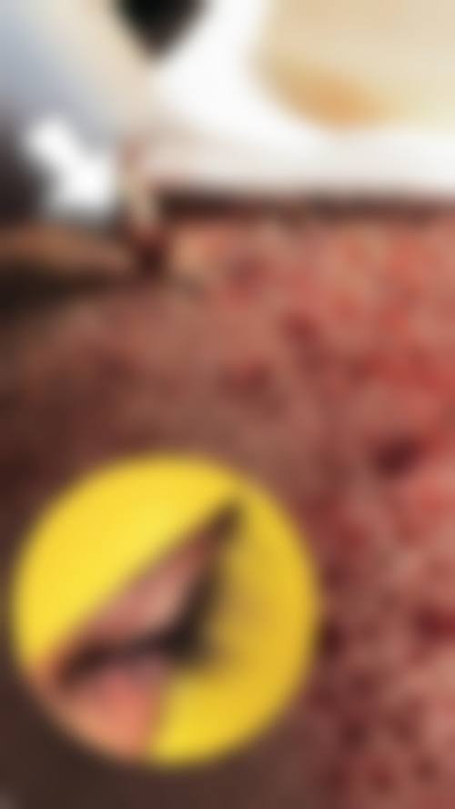 合肥新生植发医院口碑好不好?附真实患者口碑评价