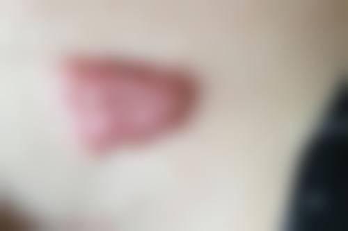 新余韩臻轻医疗美容诊所怎么样，价格表情况