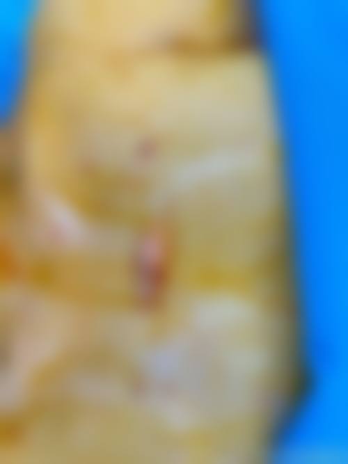 新余韩臻轻医疗美容诊所怎么样，评价情况