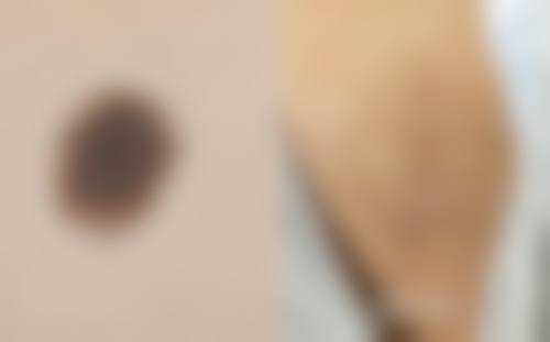 枣庄悦然整形医院真实患者口碑评价