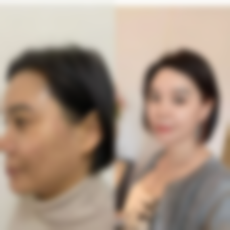 枣庄悦然整形医院价格表