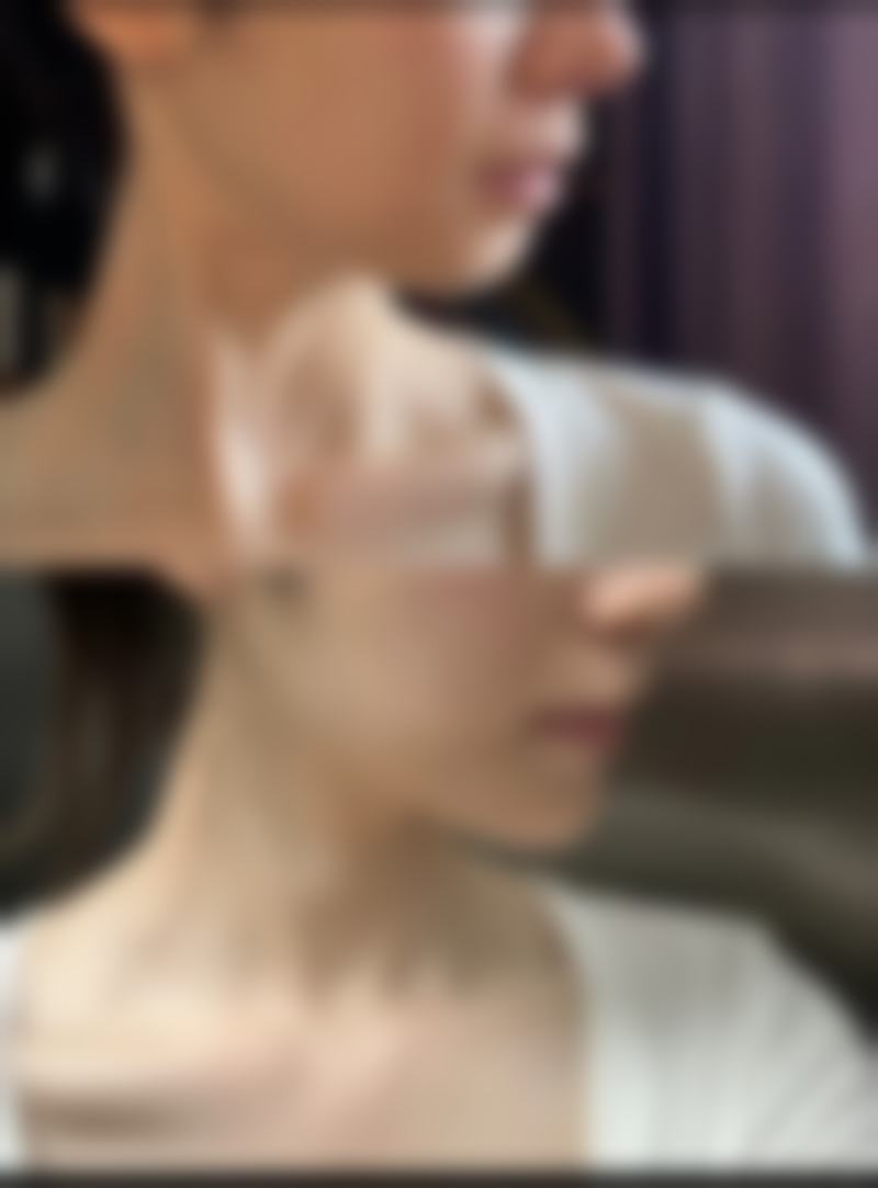 苏州伊美医疗美容诊所怎么样，更擅长什么手术