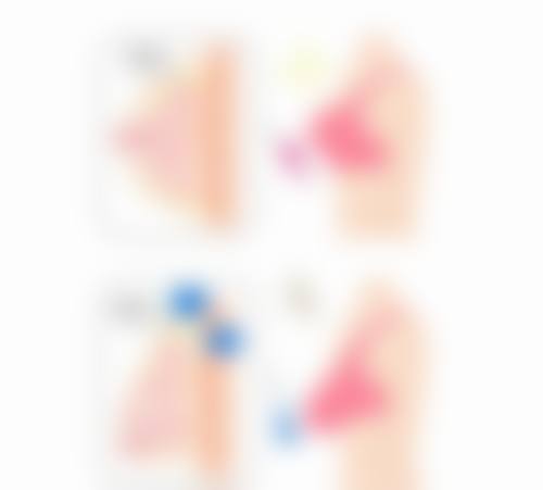 日照市人民医院美容外科怎么样之项目特色