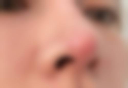 二、深圳迎悦医疗美容怎么样,资质情况如何?