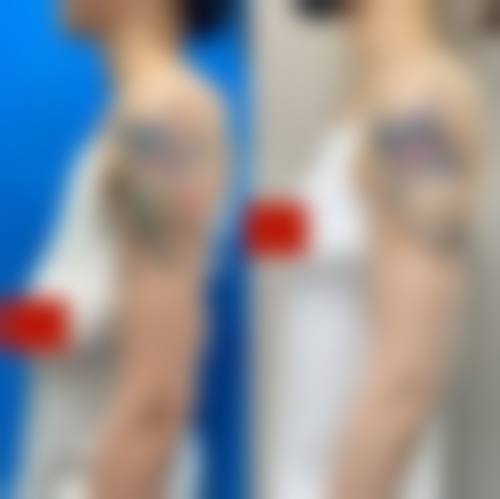 七、广西柳州解放军158医院整形美容中 心口碑好不好?附真实患者口碑评价