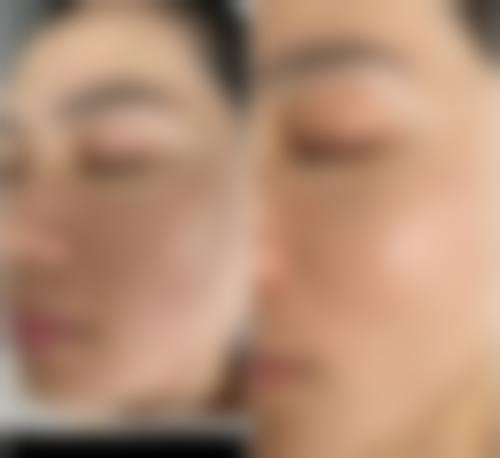 TCB富山怎么样，医生实力体现